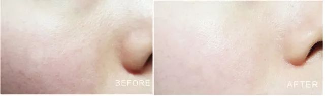 性价比逆天!大瓶好用的湿敷新宠，美白补水缩毛孔，0差评，上架就