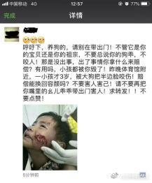 微信群内流传“内江一娃儿左腿被狗咬掉、一娃儿面部被狗咬伤”系