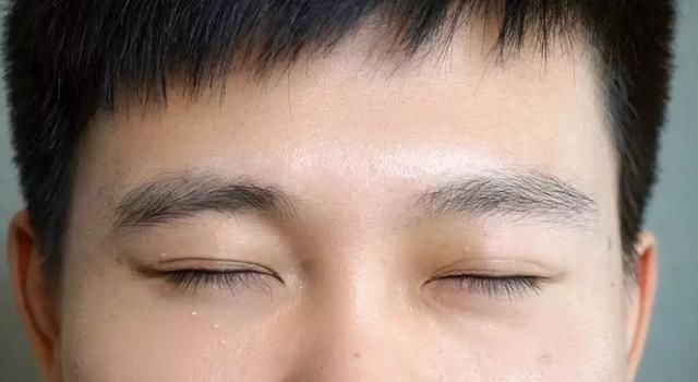 发际线男孩花2500修的眉毛这个鸟样