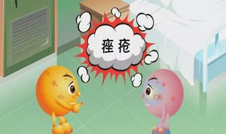  长痘■脸上长痘，牢记5个调理方法，“痘痘”会慢慢好起来！