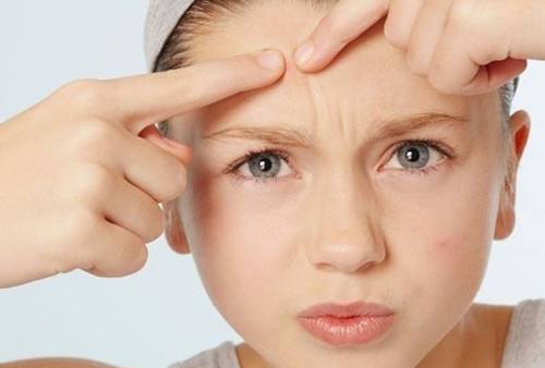 脸上的痘痘没了,留下痘印痘坑怎么办呢?