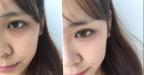  症状■肌肤变老有哪些症状?快来看看你的皮肤是否还年轻