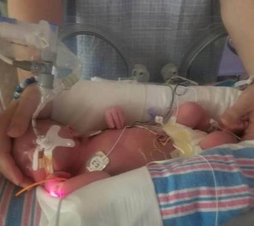 美国女子梦想成为世界最胖的人,没想到怀孕却让她瘦了200斤!