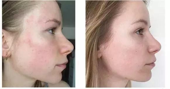 李湘瘦了之后美回来了!42岁活出22岁的少女感