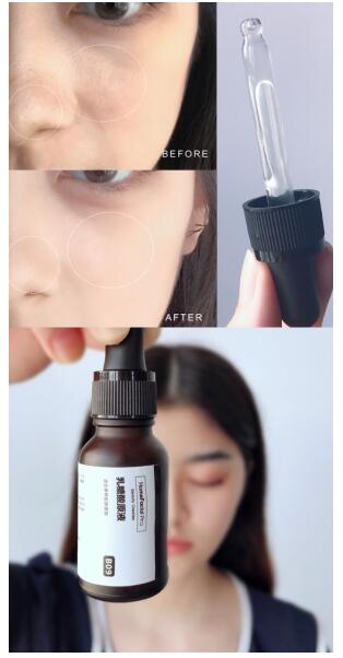 告别毛孔烦恼 HomeFacialPro新品乳糖酸原液测评