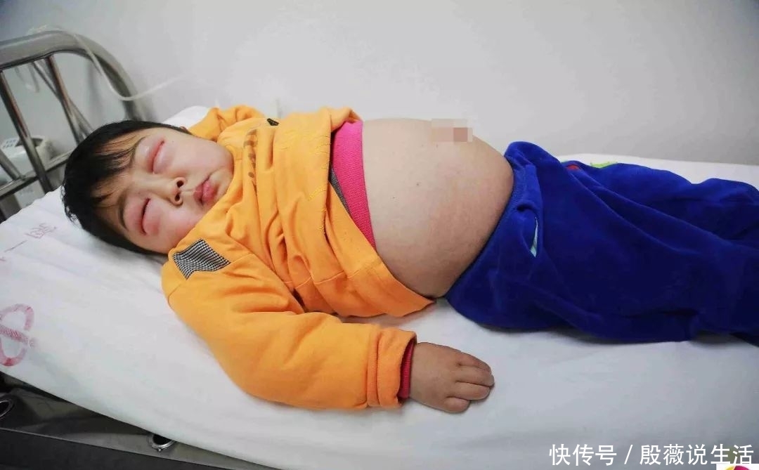 男童患怪病病好时帅帅的,发病时肚大像怀孕双