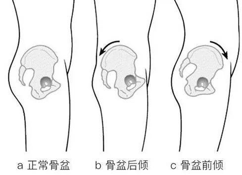 什么?穿上这条骨盆瘦身裤，任何女人都会瘦10斤?
