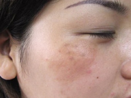 67岁阿姨像23，睡前加它洗脸用，不出一月肌肤掐出水