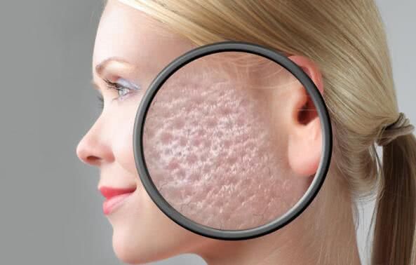 脸上感染了螨虫，会出现4现象，教你3个最佳除螨攻略