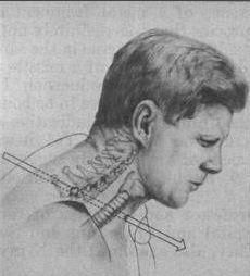 美国人真敢拍,捏造总统被刺事实,真相直指政变