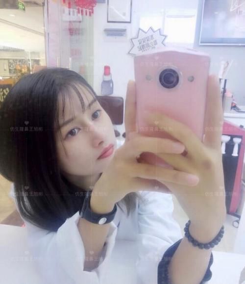  术后■鼻头肥大、山根低、没鼻梁，肋软骨隆鼻后变化有多大？