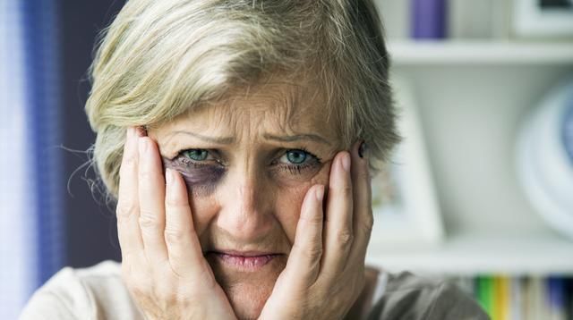 「眼部皮肤」有哪些去细纹的眼霜?