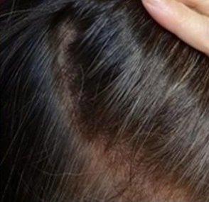 别再傻傻去染发店了!洗头时倒一点进去,满头白发瞬间乌黑靓丽