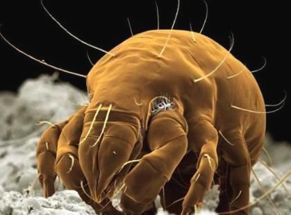 晚上睡觉闭上眼睛,700W螨虫爬过你的脸颊,一