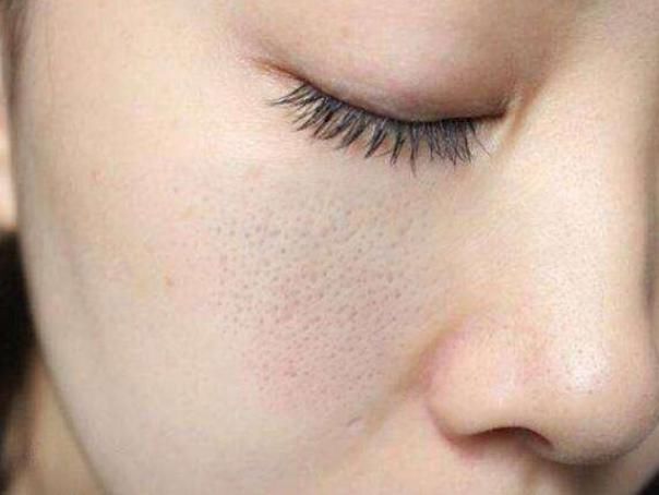 秋冬时，睡前用这几个方法洗脸，螨虫痘痘都会快速远离你