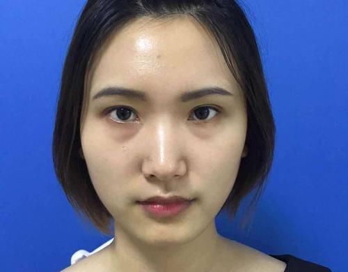  『不妨』女人开始衰老常见4个“丑态”，不妨对照下，希望你没有
