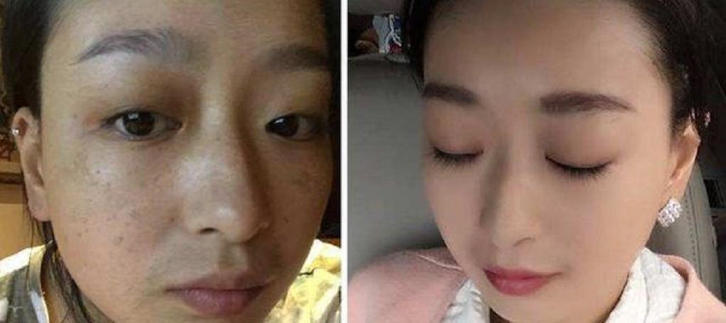  白淡斑：茄子加上“它”敷脸,15天下来美白淡斑又去皱,皮肤变得白嫩光洁