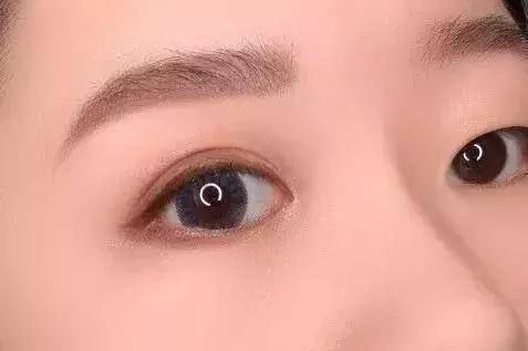 皮肤@长期贴双眼皮贴眼睛能变永久双吗?关于双眼皮谣言一次全辟谣!