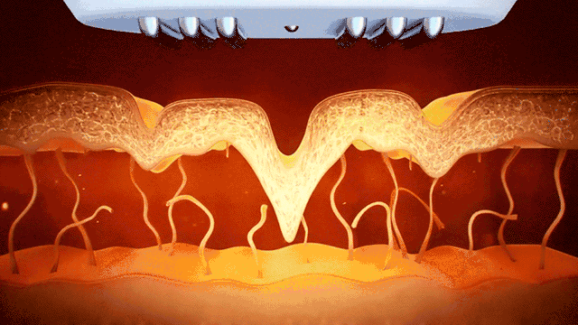 为什么这个丑萌丑萌的“青蛙头”，能独得女神们的宠爱?