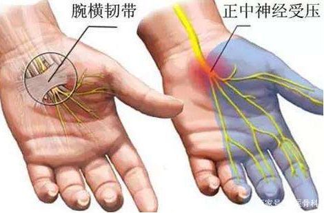  『身体』无缘无故的手麻是身体出现了问题？