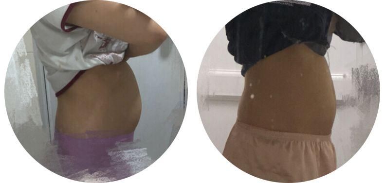 腰部赘肉、小肚腩，吃它就能消，真的管用!