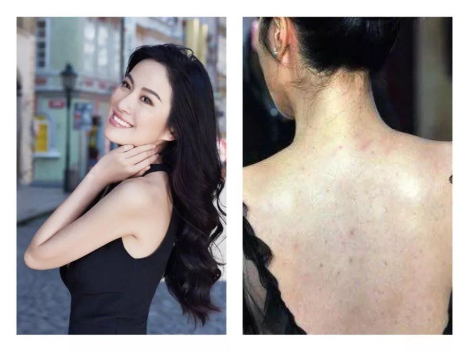 整容遭报应?她的少女脸这么快就烂了?