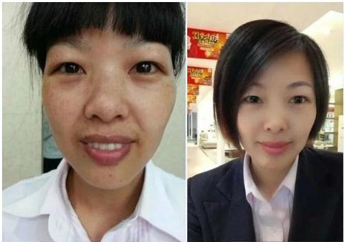 白醋祛斑真的能行吗?老中医一再提醒:斑点全部撵走完只需一瓶醋