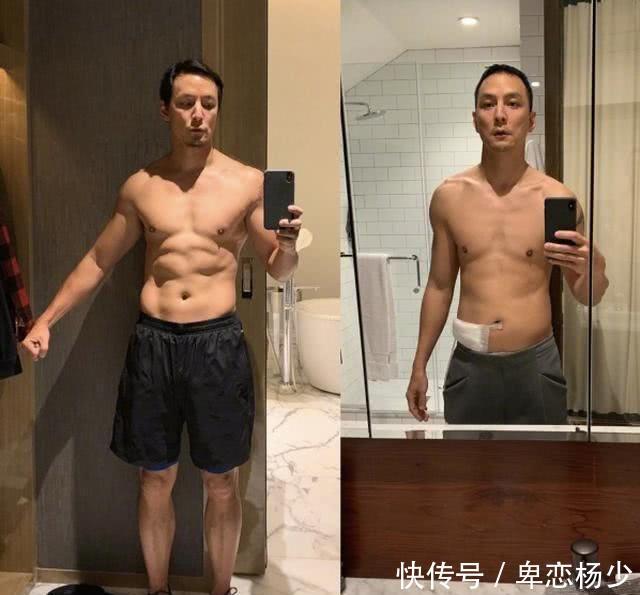  『吴彦祖』波兰知名男歌手腹痛数日未看医生，最终惨死手术台，家人悲伤发文