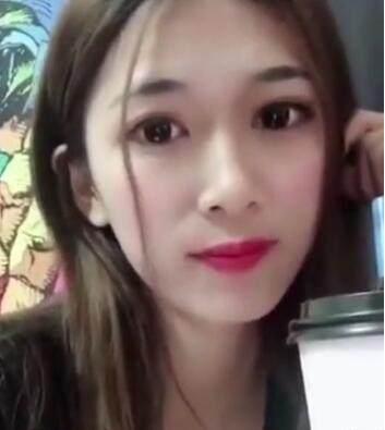 大眼睛美女做了双眼皮，男友说：恢复的挺不错的，越来越好看了