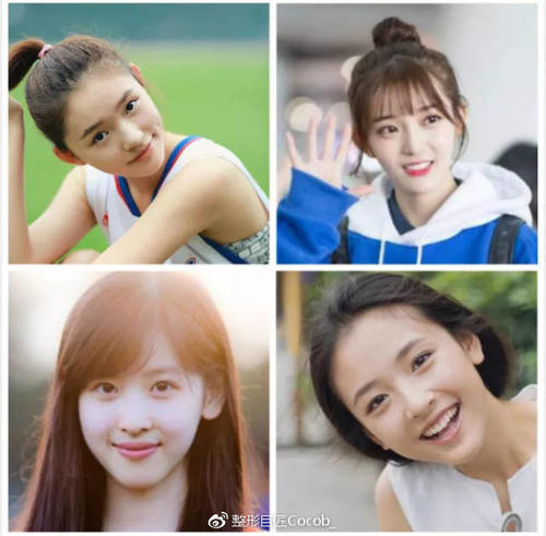 平行和扇形双眼皮该怎么选择？哪个更流行？