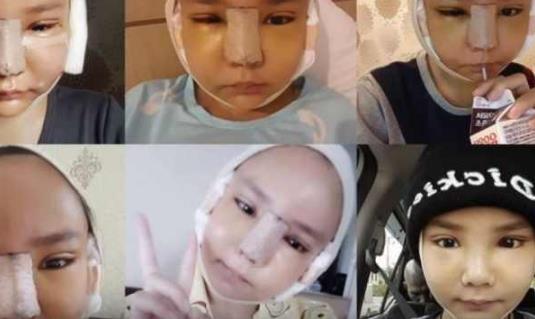 街头发现“猪头脸妹妹”,拆掉绑带以后能吓死人!