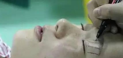 一双眼睛毁掉整张脸，这几种眼睛做双眼皮美爆了，有你没有？