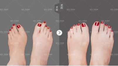 圣嘉新马桂文:美腿+玉足走红的明星你知道是谁吗