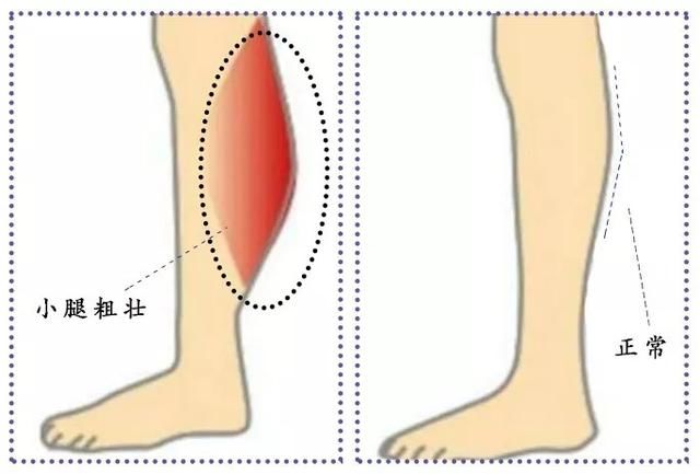 不按自己的身材选裤子，只会越穿越丑！
