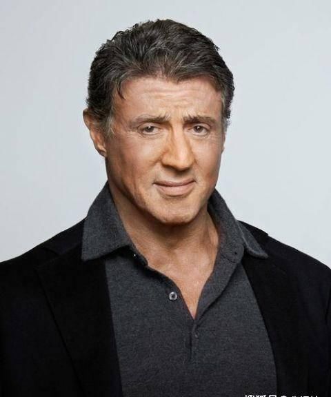 「发育不良」3张 患有残废的大牌明星，史泰龙神经损伤成面瘫，彼得丁克拉格发育不良