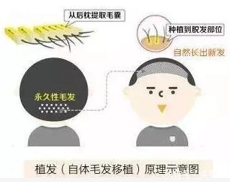  『发际』女生发际线越来越高怎么办？看这里，拒做“秃头”少女