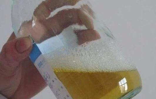 大小便时出现这几个症状,或是“癌症”的症状,发现就去医院检查 - 周公乐 - xinhua8848 的博客 大小便时出现这几个症状,或是“癌症”的症状,发现就去医院检查 - 周公乐 - xinhua8848 的博客