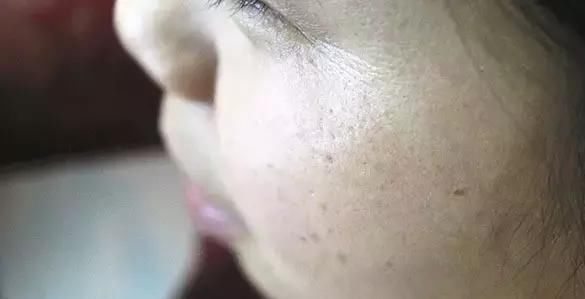  『皮肤』睡前做好这几点,你也可以拥有一个水嫩嫩的皮肤