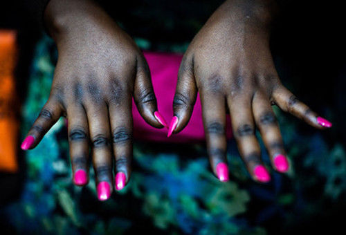 比整容还猛，非洲黑人少女流行把全身漂白