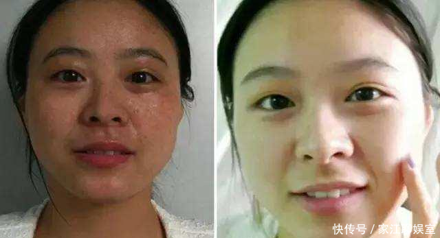 【加上】蜂蜜加上常见的“它”敷脸,15天快速淡斑美白,皮肤白皙又水嫩