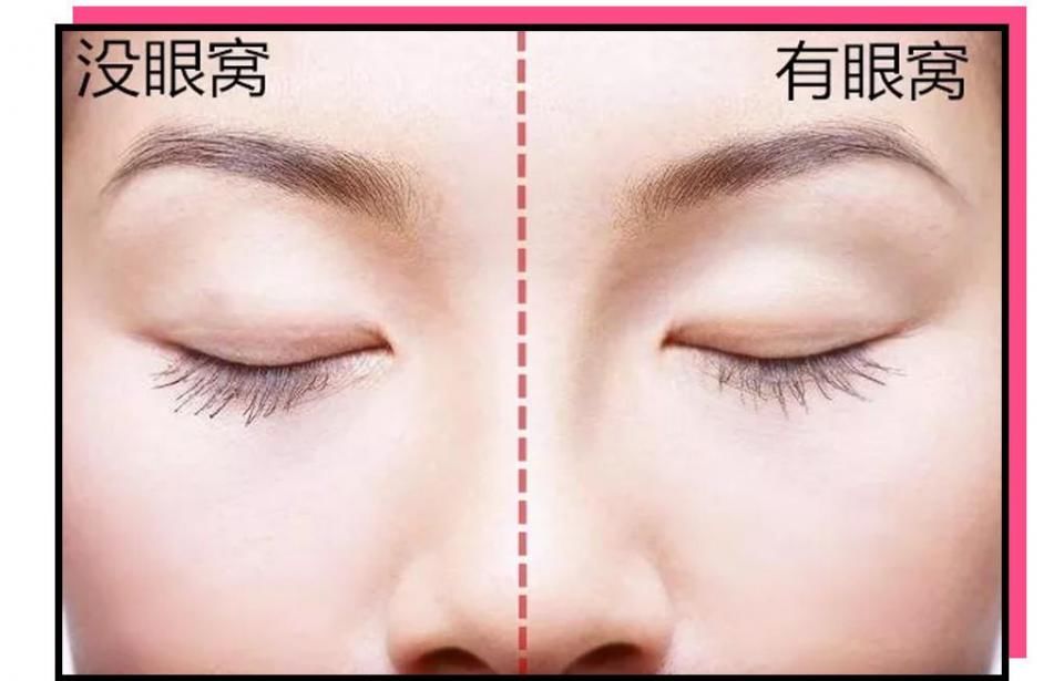 “你这个是肿眼泡，哭不出邓伦那样的双眼皮的。”