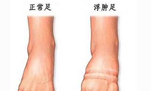  「上图可以看」塑料高腰盆养兰花总是烂根？养功不到位可不要怪盆，关键在透气