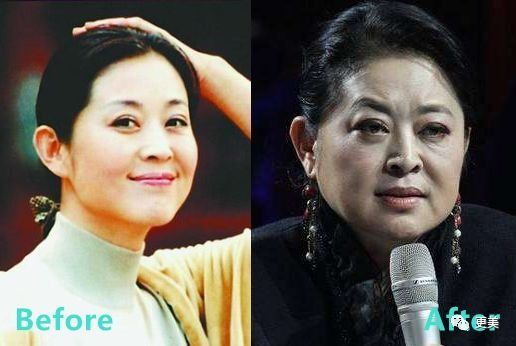 90后的郑爽关晓彤眼袋都要掉地上了，快来个医生救救她们吧!