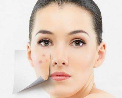 油性皮肤一到下午特别油,该怎么办?