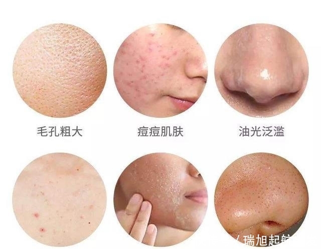 『可柏迷迭』这3个去黑头的方法,会让你变成草莓鼻,你还在用吗