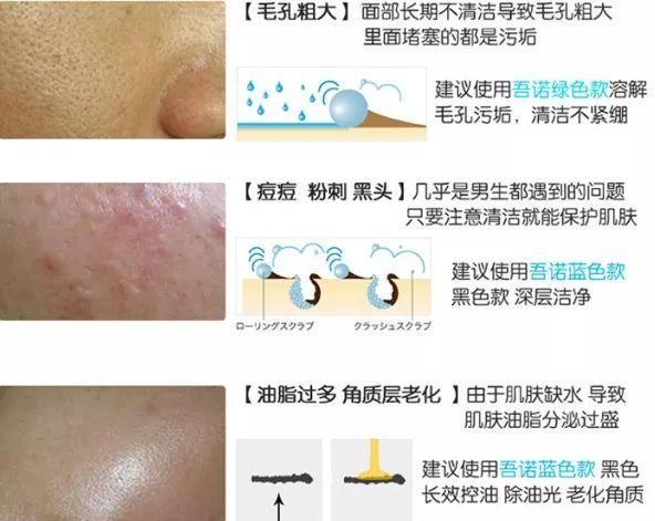 每个男人可能都听到过这句伤自尊的话:“你脸上的油都可以炒菜了.