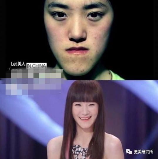 “整牙到底能不能瘦脸”终于有了权威结论,杨幂竟是被冤枉的?
