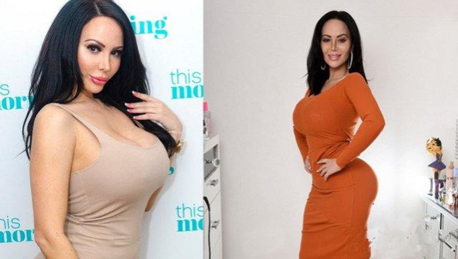 女子花费近14万整容，“只能站不能做”担心填充物会爆炸