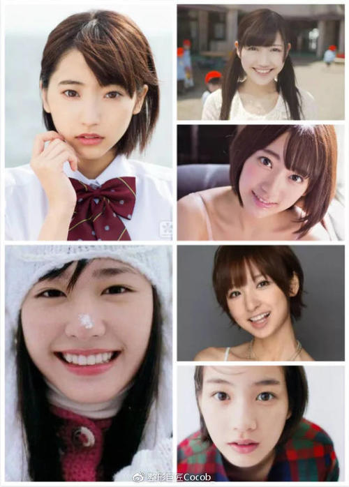 平行和扇形双眼皮该怎么选择？哪个更流行？