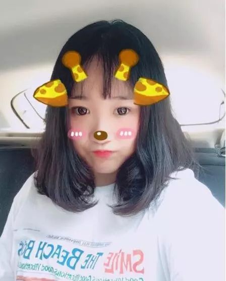 双眼皮一个月亲身经历，割对了双眼皮真的可以改变人生!